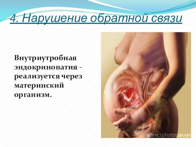 4. Нарушение обратной связи Внутриутробная эндокринопатия - реализуется через материнский организм.