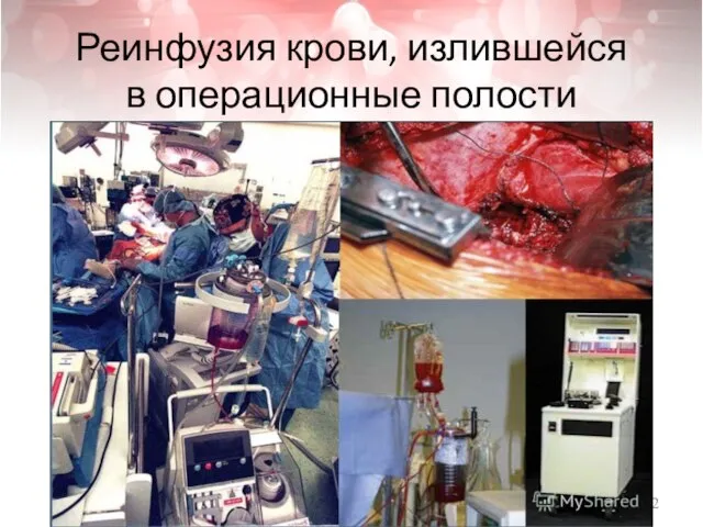 Реинфузия крови, излившейся в операционные полости