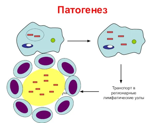 Патогенез Транспорт в регионарные лимфатические узлы Повреждение макрофага, образование доиммунной гранулемы