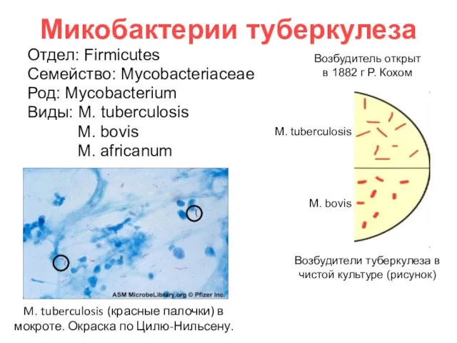 Микобактерии туберкулеза Отдел: Firmicutes Семейство: Mycobacteriaceae Род: Mycobacterium Виды: M. tuberculosis M.