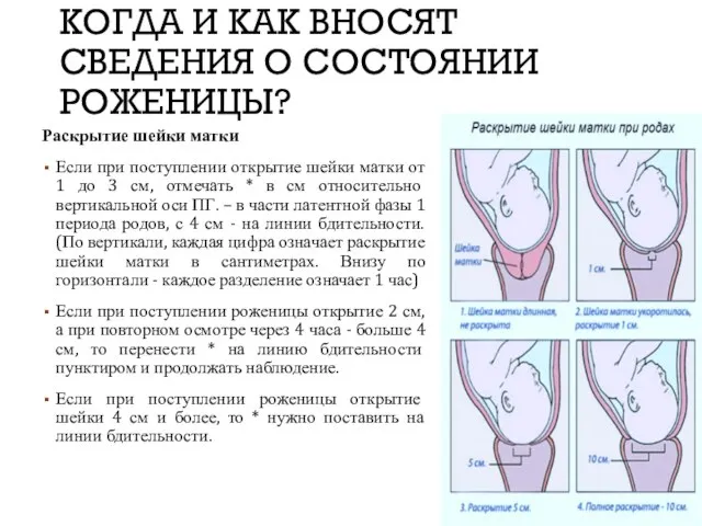 КОГДА И КАК ВНОСЯТ СВЕДЕНИЯ О СОСТОЯНИИ РОЖЕНИЦЫ? Раскрытие шейки матки Если