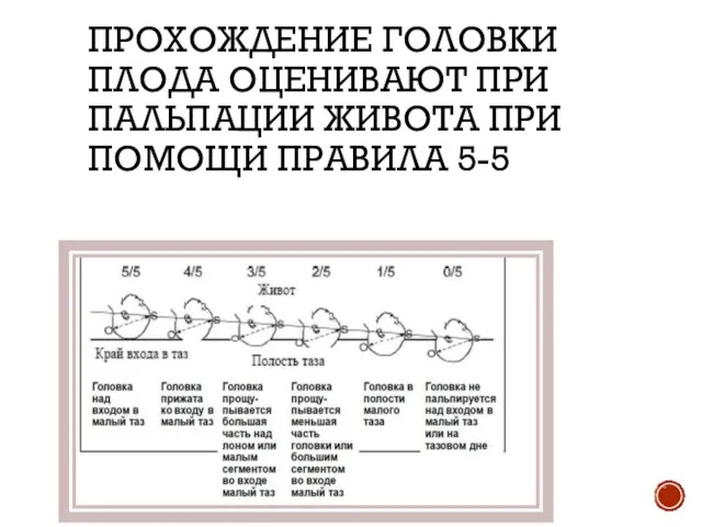 ПРОХОЖДЕНИЕ ГОЛОВКИ ПЛОДА ОЦЕНИВАЮТ ПРИ ПАЛЬПАЦИИ ЖИВОТА ПРИ ПОМОЩИ ПРАВИЛА 5-5