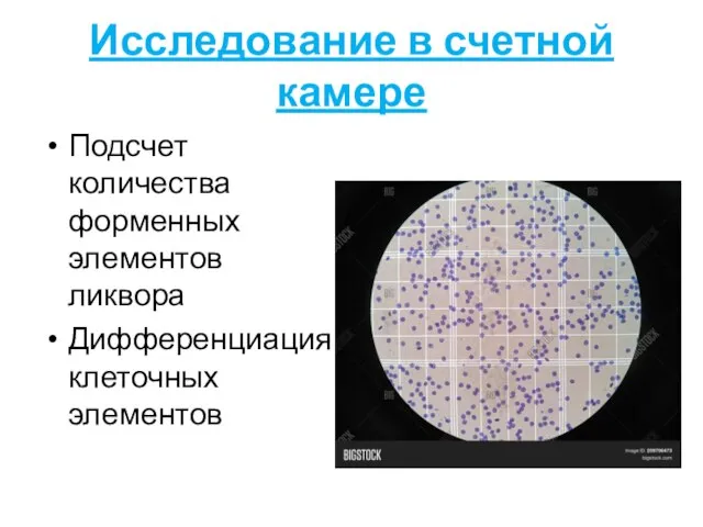 Исследование в счетной камере Подсчет количества форменных элементов ликвора Дифференциация клеточных элементов