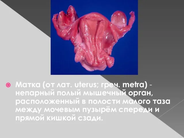 Матка (от лат. uterus; греч. metra) - непарный полый мышечный орган, расположенный