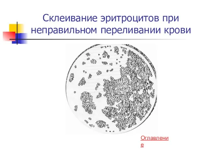 Склеивание эритроцитов при неправильном переливании крови Оглавление