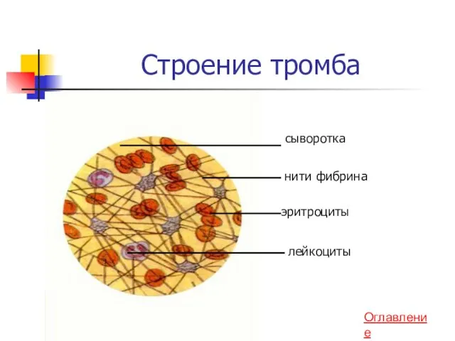 Строение тромба нити фибрина эритроциты лейкоциты сыворотка Оглавление