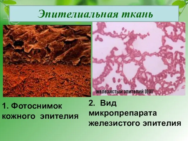 Эпителиальная ткань 1. Фотоснимок кожного эпителия 2. Вид микропрепарата железистого эпителия