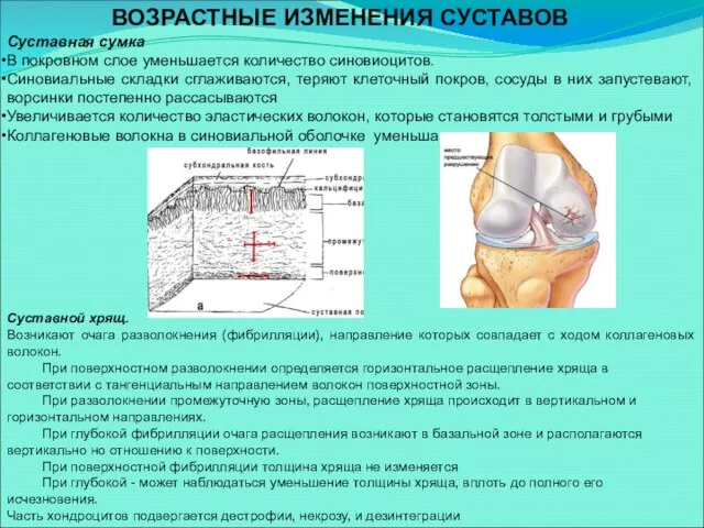 ВОЗРАСТНЫЕ ИЗМЕНЕНИЯ СУСТАВОВ Суставная сумка В покровном слое уменьшается количество синовиоцитов. Синовиальные