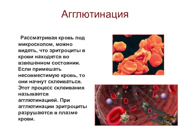 Агглютинация Рассматривая кровь под микроскопом, можно видеть, что эритроциты в крови находятся