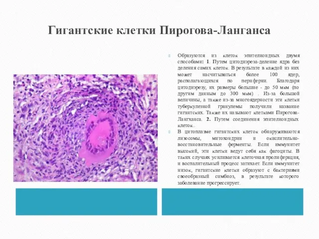 Гигантские клетки Пирогова-Ланганса Образуются из клеток эпителиоидных двумя способами: 1. Путем цитодиэреза-деление