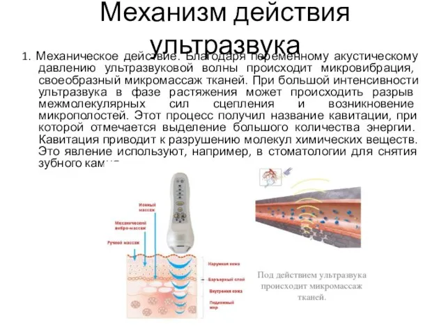 Механизм действия ультразвука 1. Механическое действие. Благодаря переменному акустическому давлению ультразвуковой волны