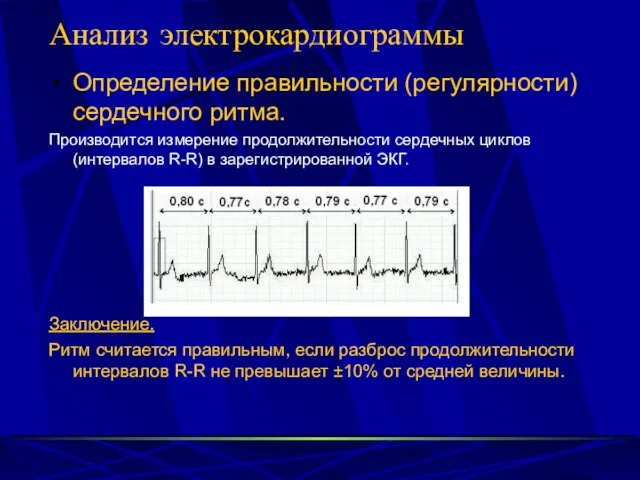 Анализ электрокардиограммы Определение правильности (регулярности) сердечного ритма. Производится измерение продолжительности сердечных циклов
