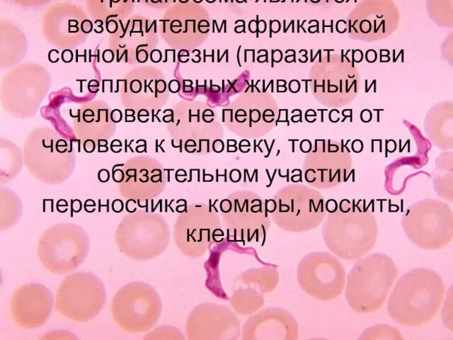 Трипаносома является возбудителем африканской сонной болезни (паразит крови теплокровных животный и человека,