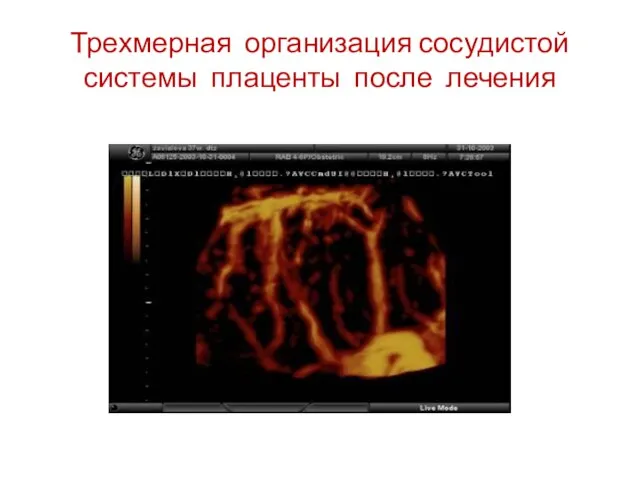 Трехмерная организация сосудистой системы плаценты после лечения