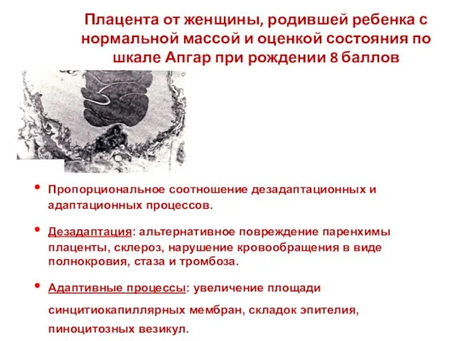 Плацента от женщины, родившей ребенка с нормальной массой и оценкой состояния по