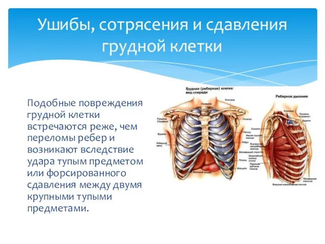 Ушибы, сотрясения и сдавления грудной клетки Подобные повреждения грудной клетки встречаются реже,