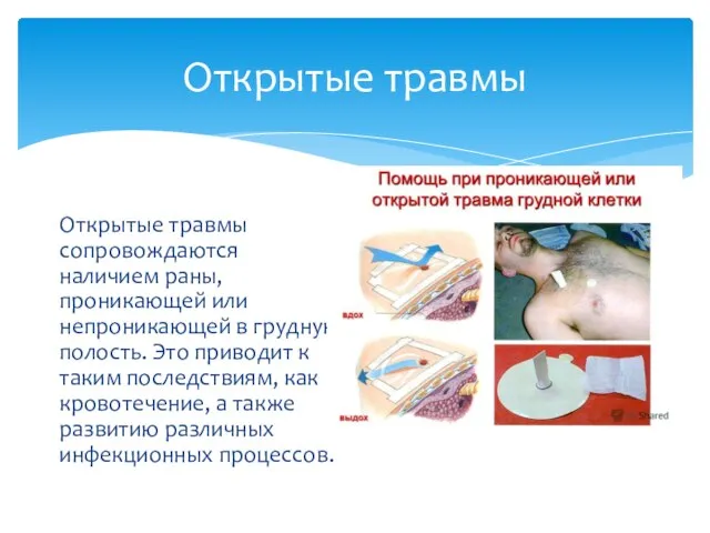 Открытые травмы Открытые травмы сопровождаются наличием раны, проникающей или непроникающей в грудную