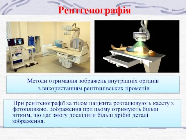 Методи отримання зображень внутрішніх органів з використанням рентгенівських променів При рентгенографії за