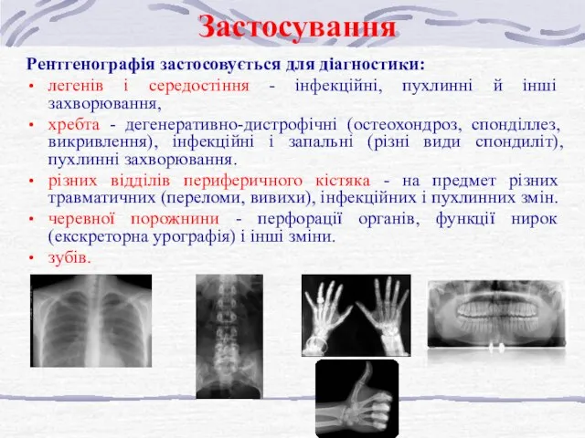 Застосування Рентгенографія застосовується для діагностики: легенів і середостіння - інфекційні, пухлинні й