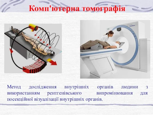 Метод дослідження внутрішніх органів людини з використанням рентгенівського випромінювання для посекційної візуалізації внутрішніх органів. Комп'ютерна томографія