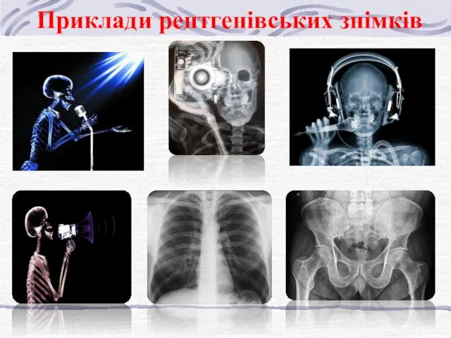 Приклади рентгенівських знімків
