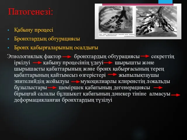 Патогенезі: Қабыну процесі Бронхтардың обтурациясы Бронх қабырғаларының осалдығы Этиологиялық фактор бронхтардың обтурациясы