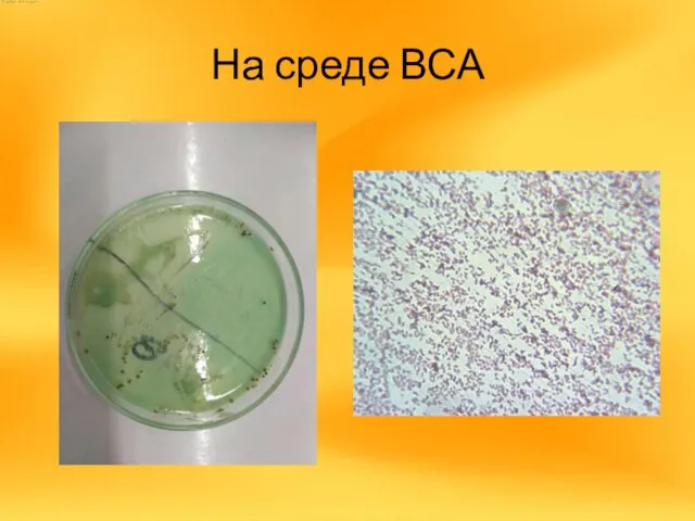 На среде ВСА