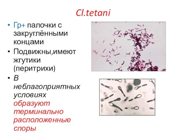 Cl.tetani Гр+ палочки с закруглёнными концами Подвижны,имеют жгутики (перитрихи) В неблагоприятных условиях образуют терминально расположенные споры