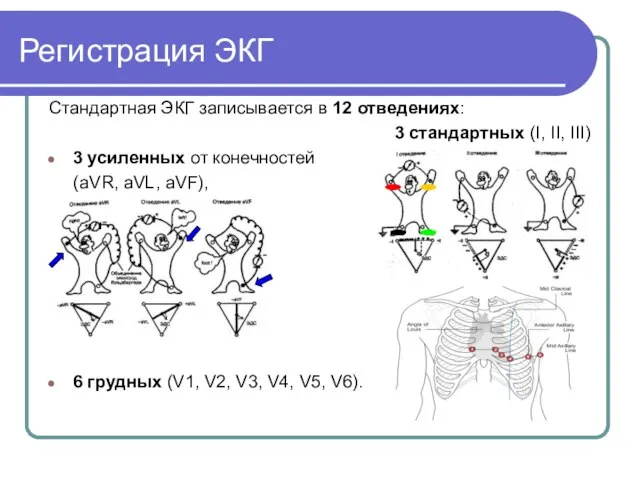 Регистрация ЭКГ Стандартная ЭКГ записывается в 12 отведениях: 3 стандартных (I, II,