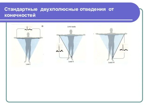 Стандартные двухполюсные отведения от конечностей