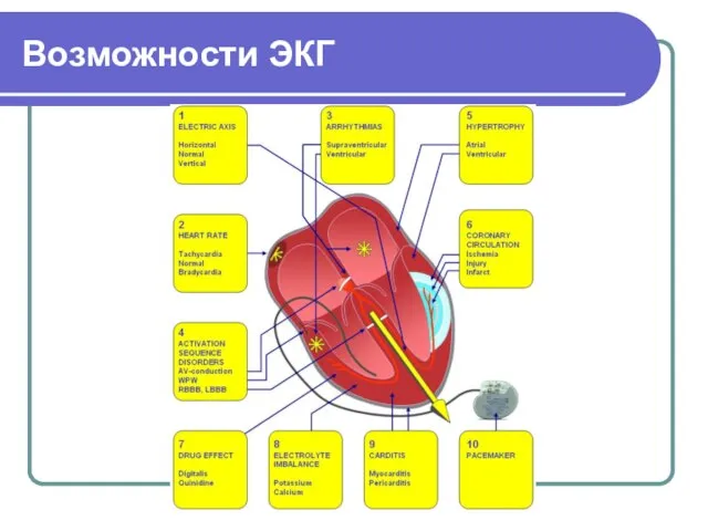 Возможности ЭКГ