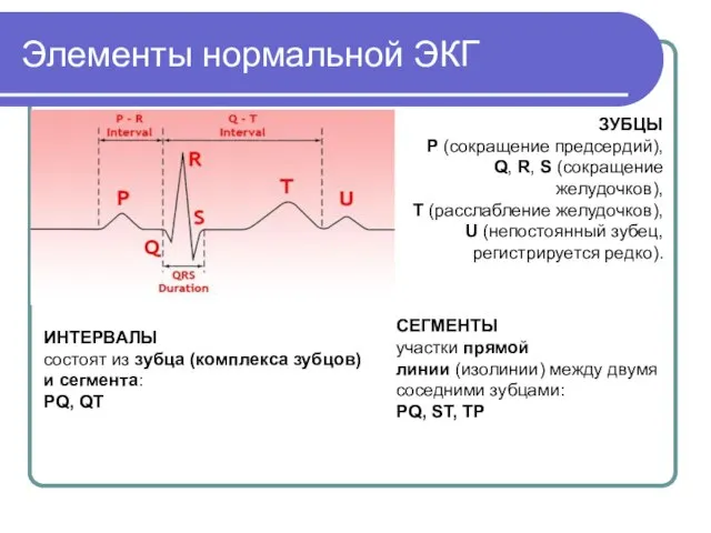 Элементы нормальной ЭКГ ЗУБЦЫ P (сокращение предсердий), Q, R, S (сокращение желудочков),