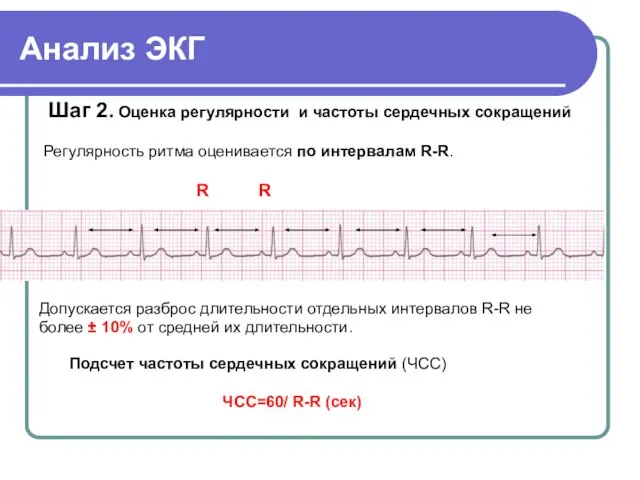 Анализ ЭКГ Шаг 2. Оценка регулярности и частоты сердечных сокращений Регулярность ритма