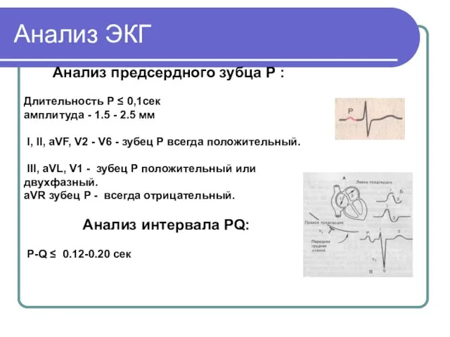 Анализ ЭКГ Анализ предсердного зубца P : Длительность Р ≤ 0,1сек амплитуда