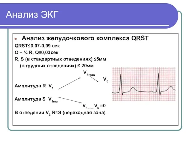 Анализ ЭКГ Анализ желудочкового комплекса QRST QRST≤0,07-0,09 сек Q – ¼ R,