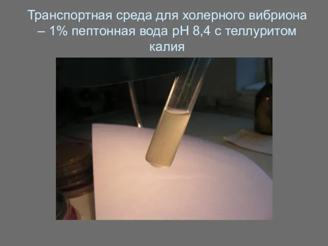 Транспортная среда для холерного вибриона – 1% пептонная вода рН 8,4 с теллуритом калия