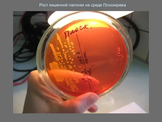 Рост кишечной палочки на среде Плоскирева