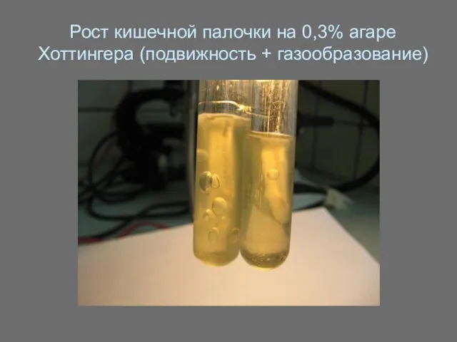 Рост кишечной палочки на 0,3% агаре Хоттингера (подвижность + газообразование)
