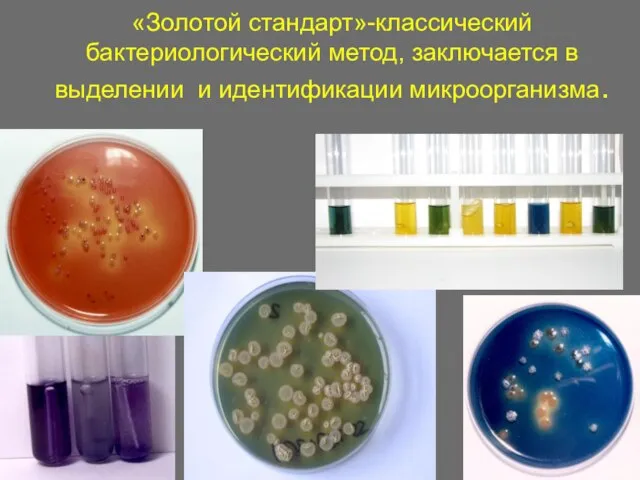 «Золотой стандарт»-классический бактериологический метод, заключается в выделении и идентификации микроорганизма.