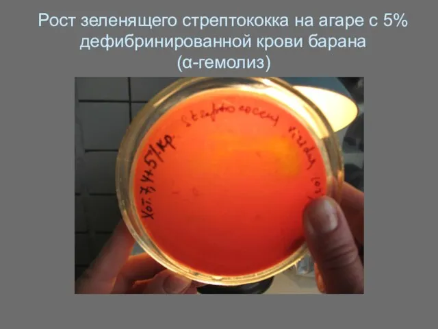 Рост зеленящего стрептококка на агаре с 5% дефибринированной крови барана (α-гемолиз)