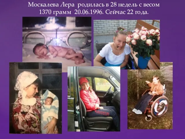 Москалева Лера родилась в 28 недель с весом 1370 грамм 20.06.1996. Сейчас 22 года.