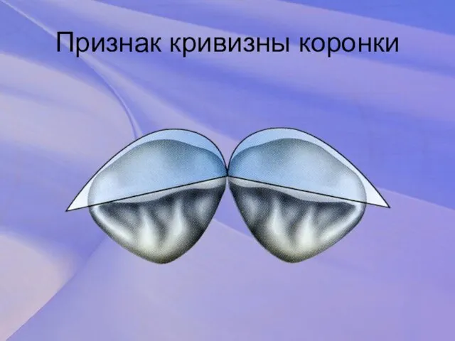 Признак кривизны коронки