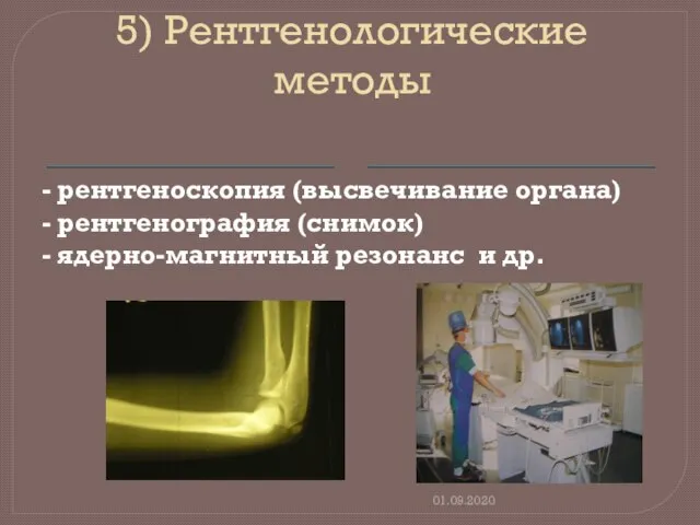 5) Рентгенологические методы - рентгеноскопия (высвечивание органа) - рентгенография (снимок) - ядерно-магнитный резонанс и др. 01.09.2020