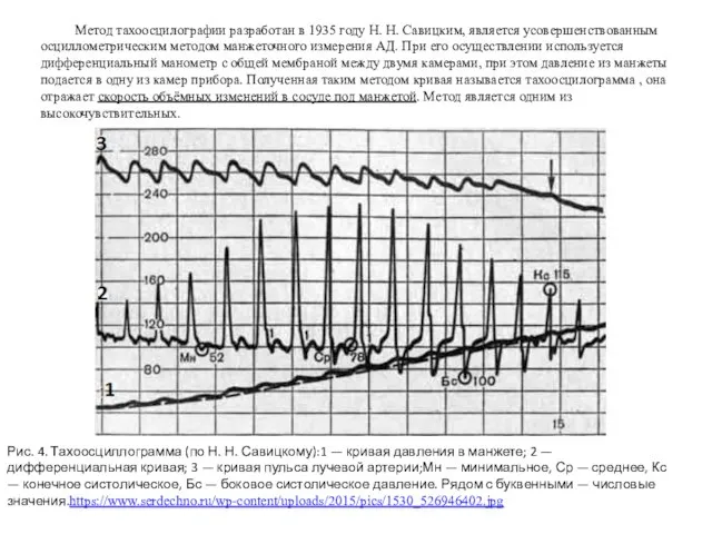 Метод тахоосцилографии разработан в 1935 году Н. Н. Савицким, является усовершенствованным осциллометрическим