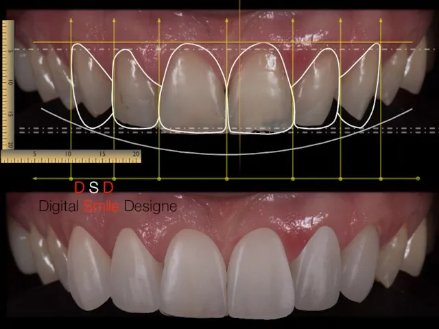 Digital Smile Designe D S D