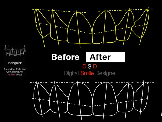 D S D Digital Smile Designe