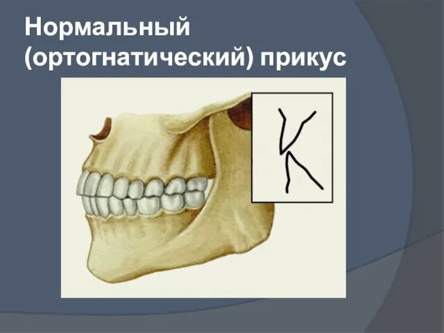 Нормальный (ортогнатический) прикус