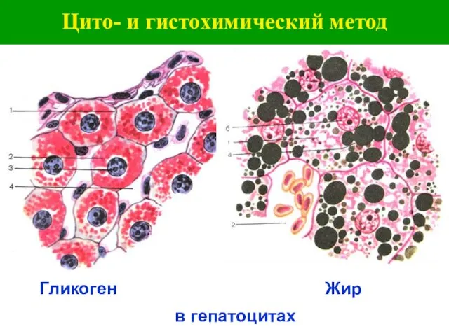 Цито- и гистохимический метод Гликоген Жир в гепатоцитах