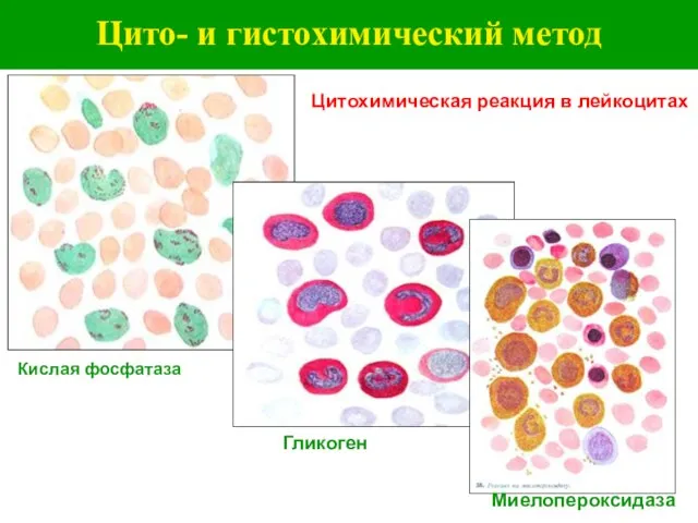 Цито- и гистохимический метод Цитохимическая реакция в лейкоцитах Кислая фосфатаза Гликоген Миелопероксидаза