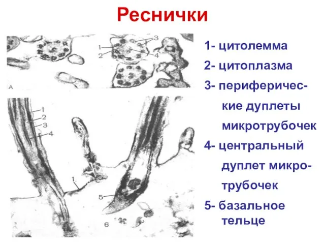 Реснички 1- цитолемма 2- цитоплазма 3- периферичес- кие дуплеты микротрубочек 4- центральный